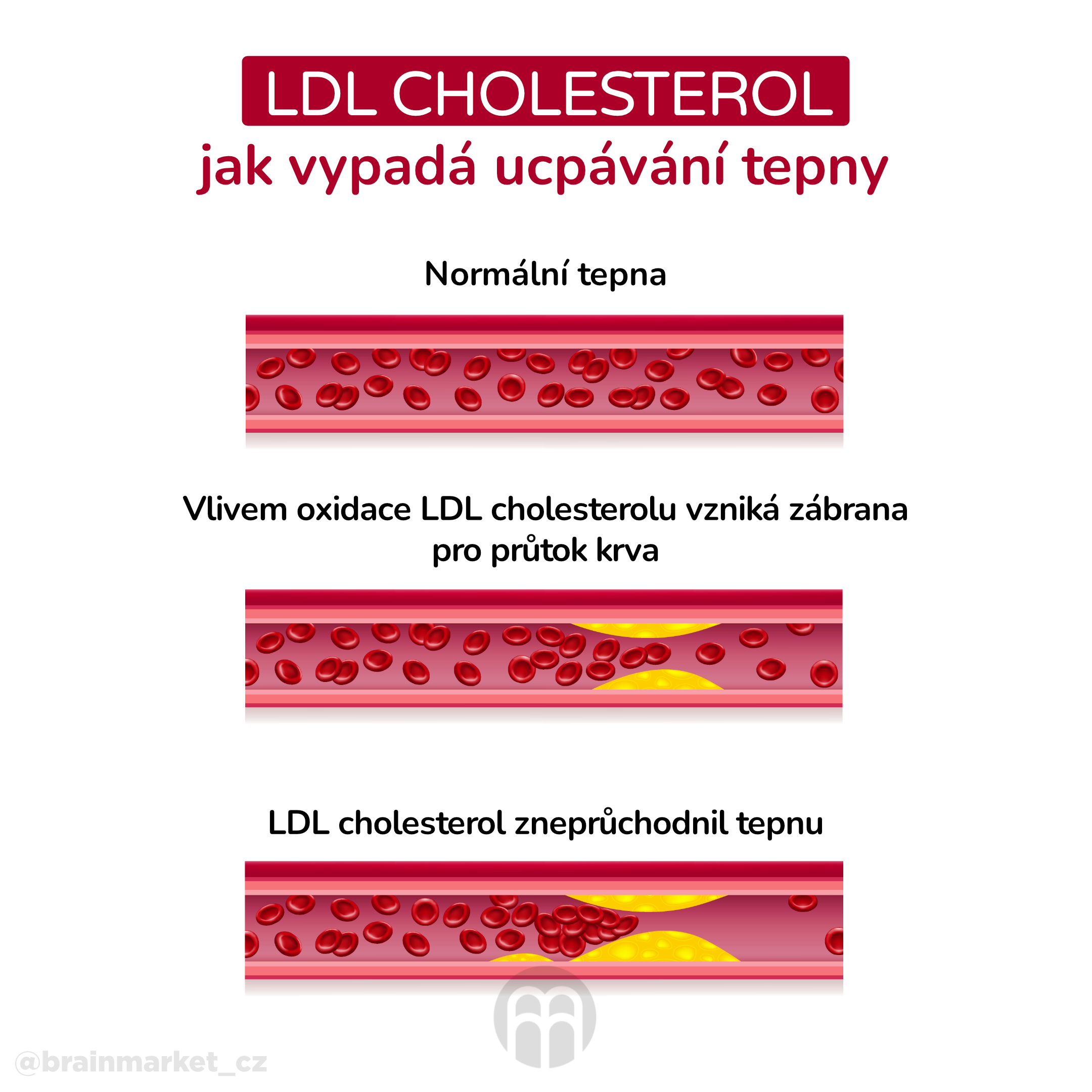 LDL cholesterol_infografika_cz